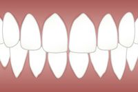 Ефектни зъбни импланти цени 9